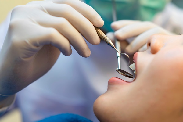 What Is A Dental Crown?