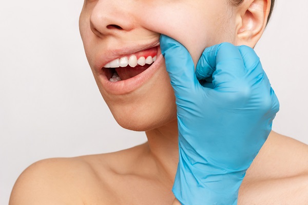 Routine Dental Checkups Can Help Prevent Gum Disease